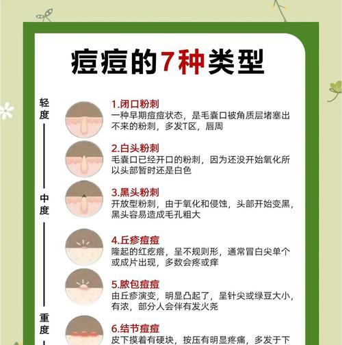 消灭青春痘，告别烦恼（从根本上解决青春痘问题）